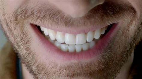 American Association of Orthodontists TV Spot, 'The Expert Smile'