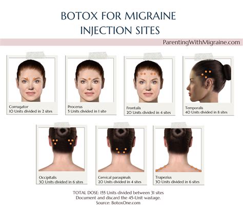 BOTOX (Migraine) Chronic Migraine logo