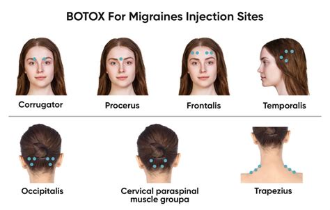 BOTOX (Migraine) Cosmetic logo