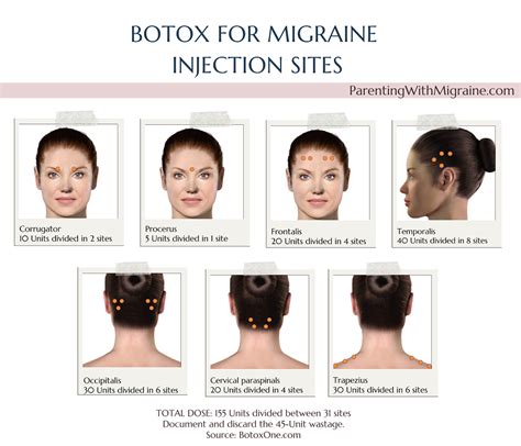 BOTOX (Migraine) Chronic Migraine tv commercials