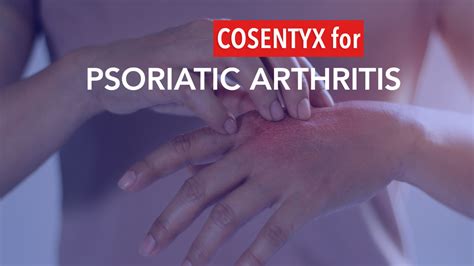 COSENTYX (Psoriatic Arthritis) tv commercials