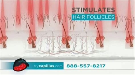 Capillus Laser Cap TV Spot, 'Treat Hair Loss at Home'