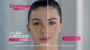 Cicatricure Brightening Cream TV Spot, 'Anti-manchas: tratarlas'