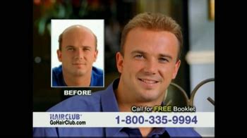 Hair Club TV commercial - Dont Tolerate Hair Loss