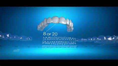 Invisalign TV Spot, 'Broad Range of Dental Issues'