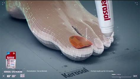 Kerasal Fungal Nail Renewal TV commercial - The Difference