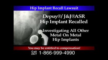 Lee Murphy Law TV Spot, 'Hip Implant Recall'