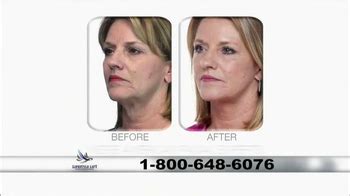 Lifestyle Lift TV commercial - A Life-Changing Procedure