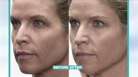 MD Complete Anti-Aging Kit TV commercial - The Results Are In