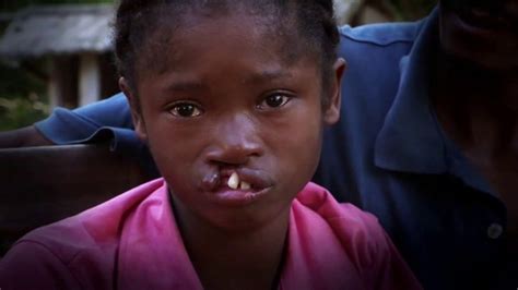 Operation Smile TV Spot, 'Every Child is Beautiful'