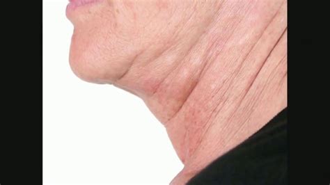 Perricone MD TV Spot, 'Visibily Firmer Neck: 20 Dollars Off'