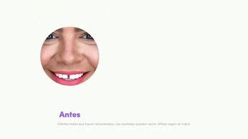 Smile Direct Club TV commercial - Día nuevo, decisiones nuevas