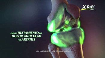 X Ray DOL TV Spot, 'Entender la articulación' created for X Ray