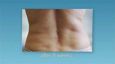 Zeltiq Aesthetics CoolSculpting TV commercial - See a Slimmer You